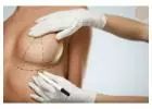 Elevate Your Confidence: Breast Lift in Newport Beach