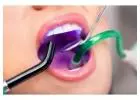 Dental laser treatment