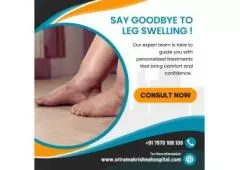 Treatment for Swollen Feet in Coimbatore
