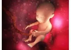 Abortion in Bangalore