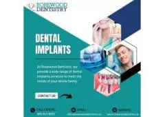 Dental Implant Services in Hamilton