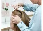 Expert Hair Dermatologist Services at London Dermatology Clinics