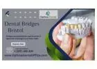Restore Your Smile: Optima Dental Office Offers Quality Dental Bridges in Bristol