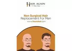 Best Non Surgical Hair Replacement